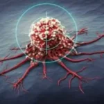 ورزش خطر سرطان