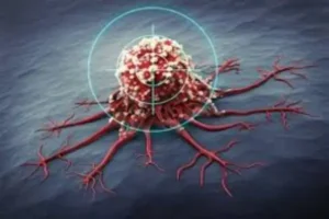 ورزش خطر سرطان